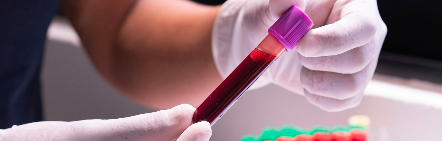 Blood Test: A Powerful Monitor Of Health